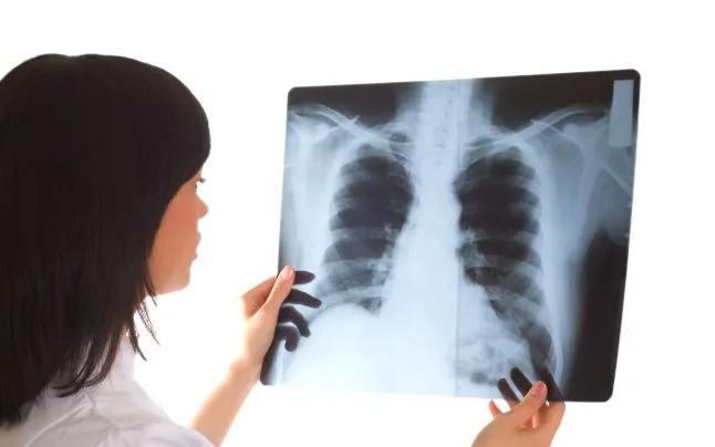 Scandalul radiografiilor de la Spitalul Slatina. Unele aparțineau altor medici