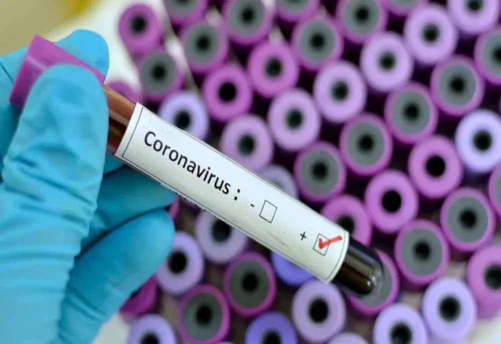 126 de cazuri confirmate cu COVID-19, în judeţul Olt. Ultima îmbolnăvire, legătură cu un focar