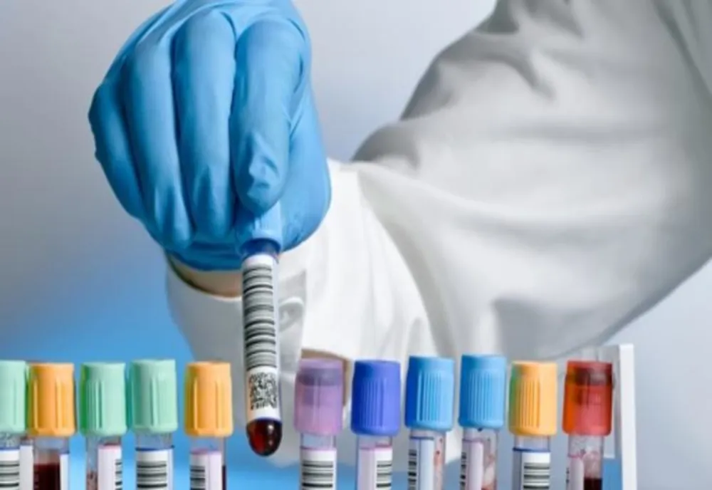 SCANDAL LA SPITALUL JUDEȚEAN SLATINA. SUBSTANȚĂ EXPIRATĂ, DESTINATĂ DEPISTĂRII CANCERULUI, FOLOSITĂ LA ANALIZE 