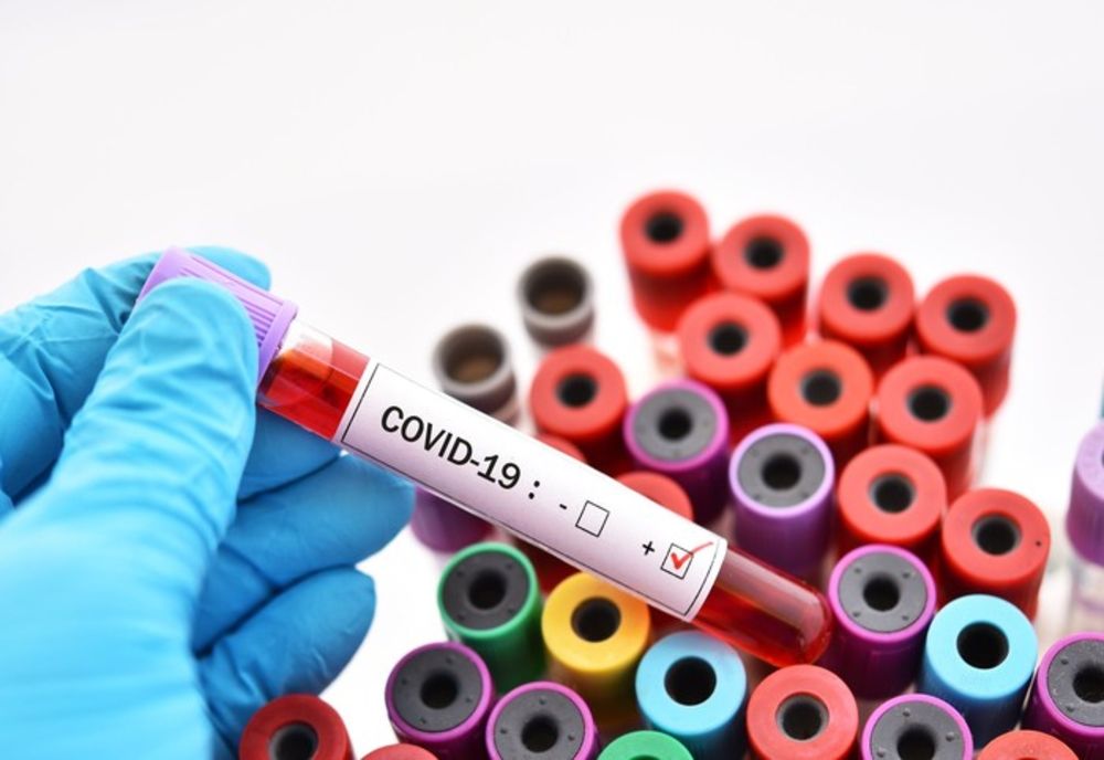 Autorităţile din Olt deblochează bani din Fondul de rezervă pentru coronavirus