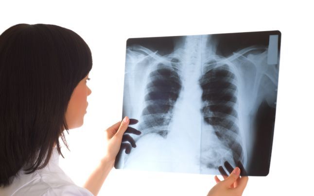 radiografii