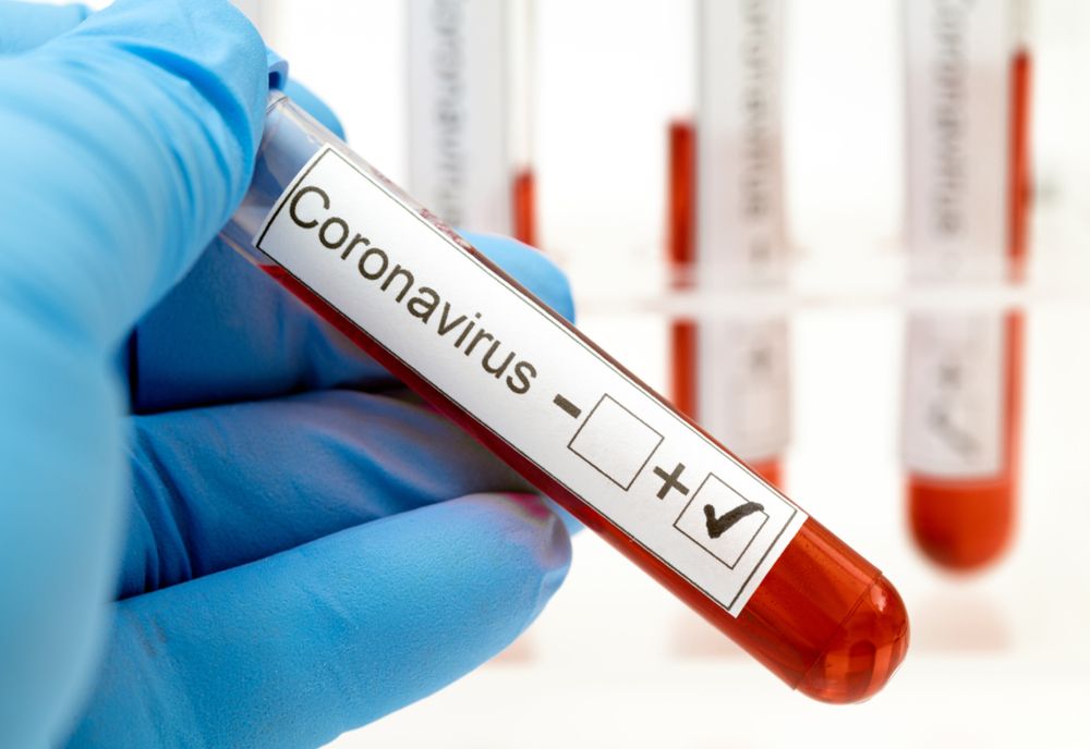 Coronavirus Olt: Niciun caz nou, în ultimele 24 de ore