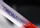 Bărbatul de 51 de ani, din Caracal, internat la Craiova, testat pozitiv pentru coronavirus. Bilanțul oficial: 17 cazuri