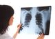 Scandalul radiografiilor de la Spitalul Slatina. Unele aparțineau altor medici