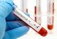 Coronavirus Olt: Niciun caz nou, în ultimele 24 de ore