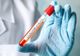 Coronavirus | Situaţia la zi, în judeţul Olt
